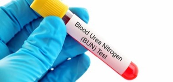 בדיקת רמת BUN בדם (Blood Urea Nitrogen)   - תמונה